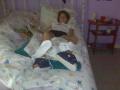Maddie recovering from foot surgery_10.JPG